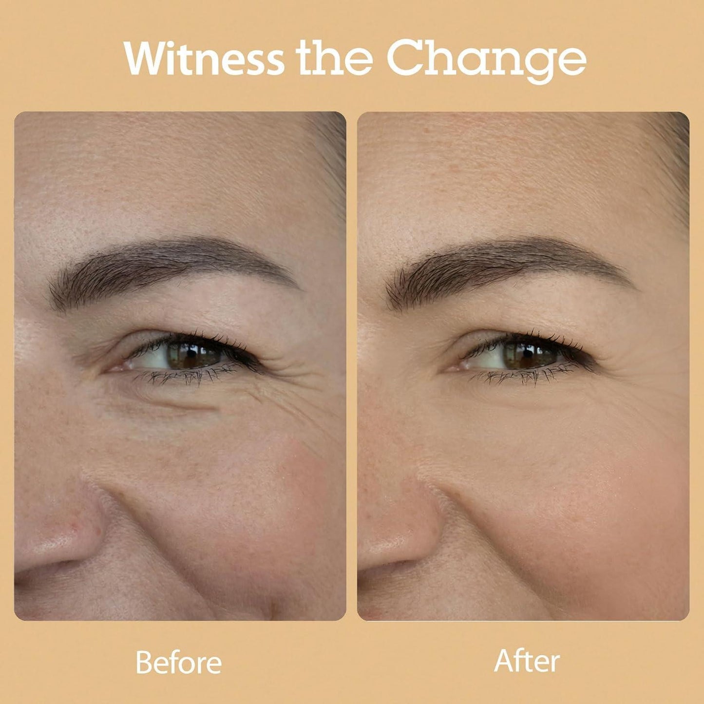 [Blithe] Vital Treatment 8 Nourishing Beans 150ml