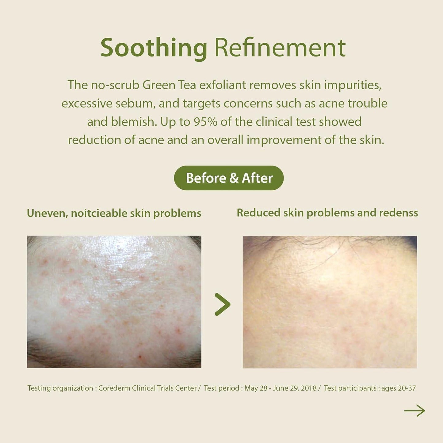 [Blithe] Patting Splash Mask Soothing & Healing Green Tea 150ml