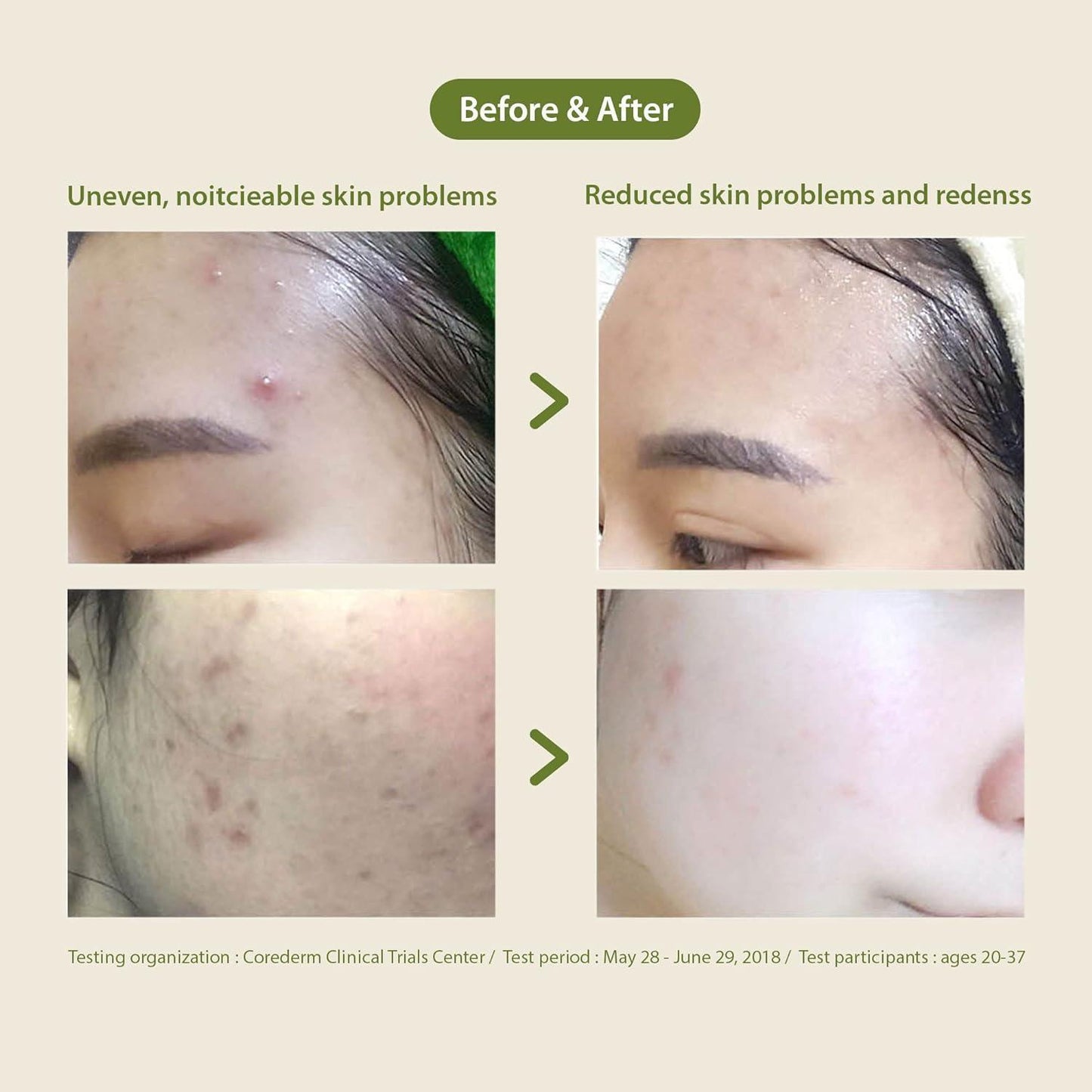 [Blithe] Patting Splash Mask Soothing & Healing Green Tea 150ml