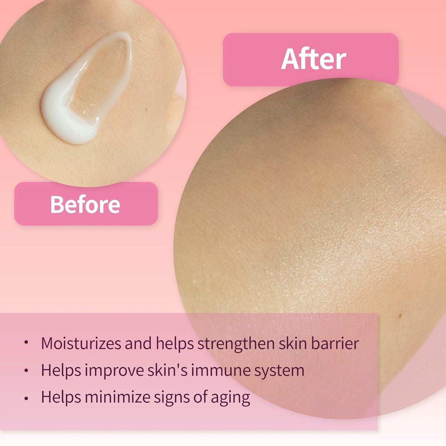 [NeoGen] DERMALOGY PROBIOTICS RELIEF CREAM 50G