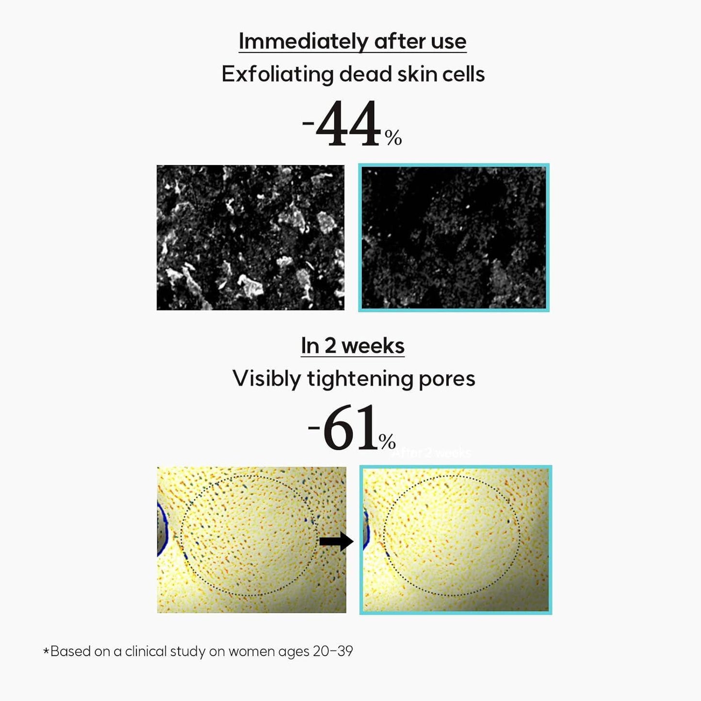 [Hanyul] Chestnut Shell Hydrating Pore Mask 100ml