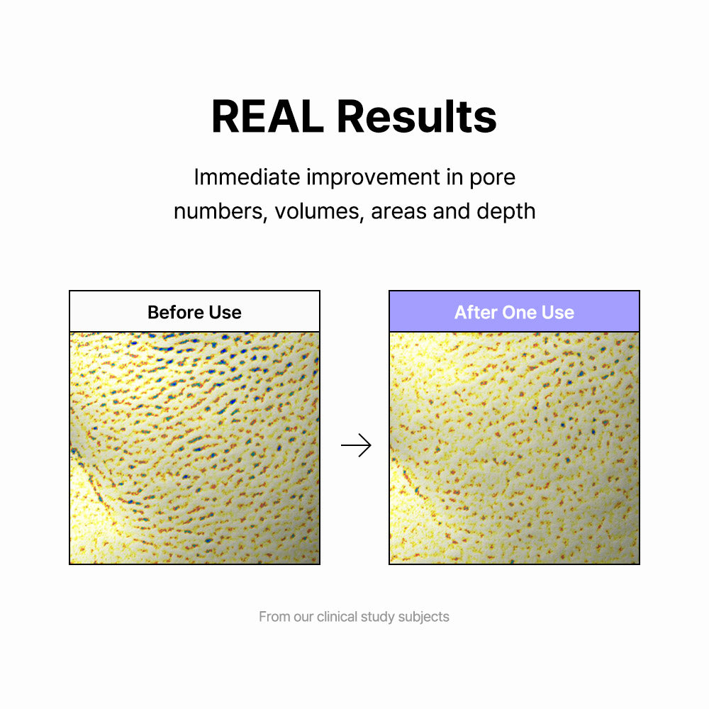 [ByWishtrend] Vitamin A-mazing Bakuchiol Night Cream 30g